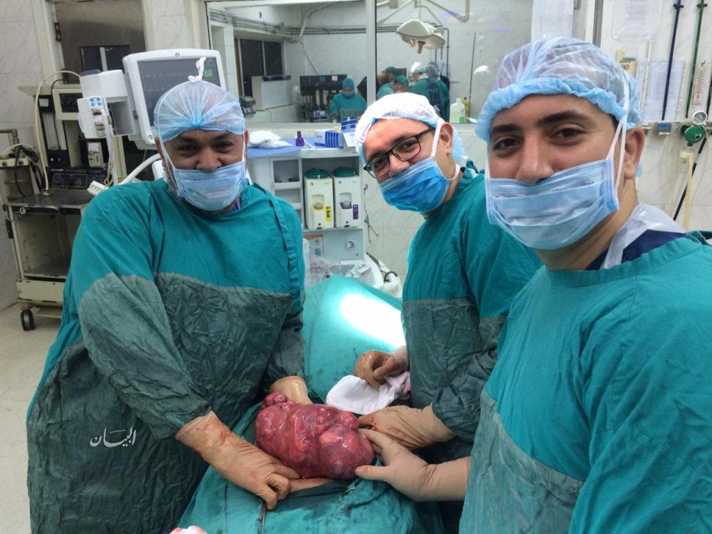 فريق طبى بمركز أورام طنطا ينجح فى إستئصال ورم ضخم من سيدة تبلغ من العمر55عاماً